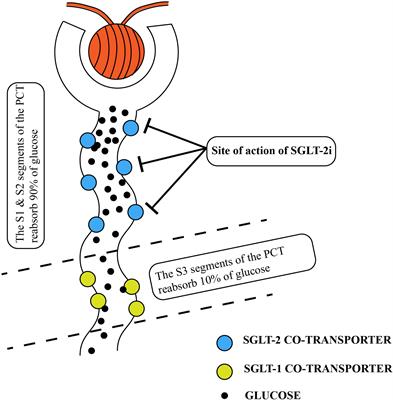 Role and mechanisms of SGLT-2 inhibitors in the treatment of diabetic kidney disease